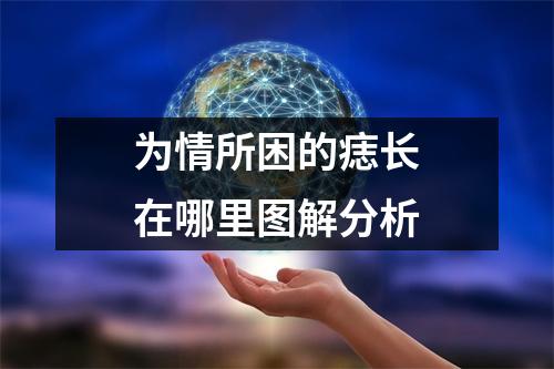 为情所困的痣长在哪里图解分析