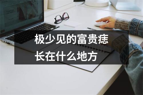 极少见的富贵痣长在什么地方