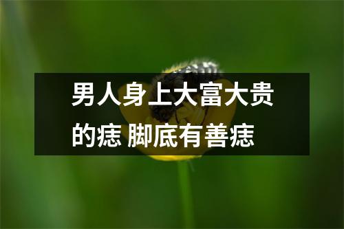男人身上大富大贵的痣脚底有善痣