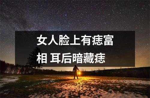 女人脸上有痣富相耳后暗藏痣